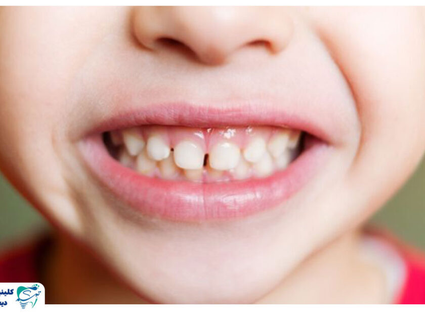 Childrens dentistry 840x620