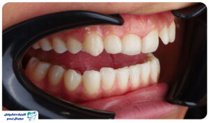 ارتودنسی اقساطی در شیراز