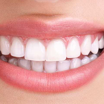 laser teeth whitening services