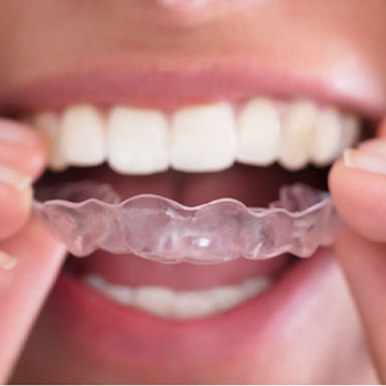 orthodontics