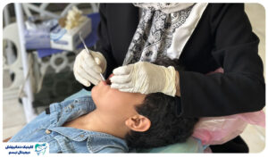 دندانپزشکی کودکان با بیهوشی در شیراز