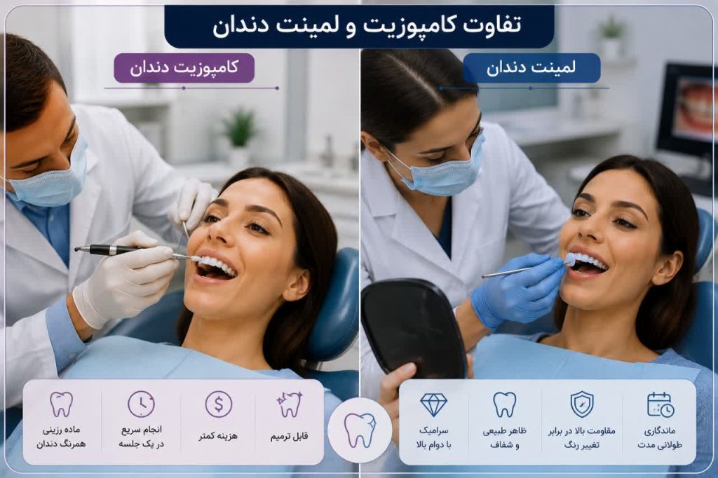 تفاوت کامپوزیت و لمینت دندان چیست؟