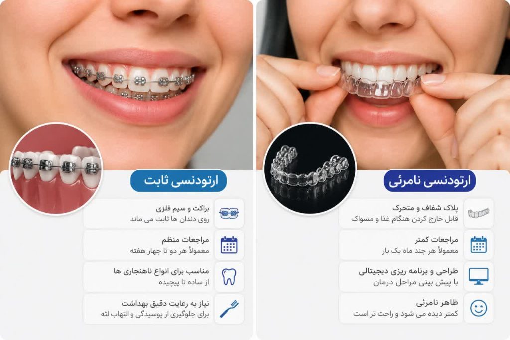تفاوت ارتودنسی ثابت و ارتودنسی نامرئی 