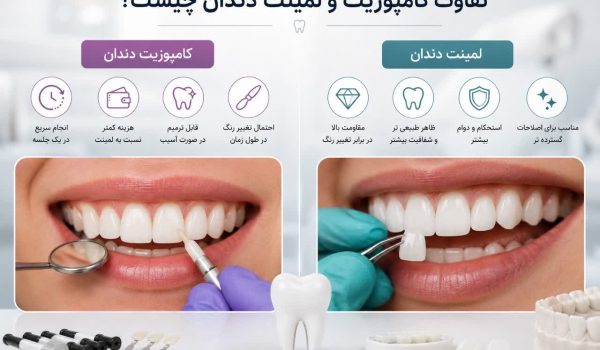 تفاوت کامپوزیت و لمینت دندان چیست؟