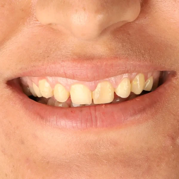فاطمه صلاح قبل